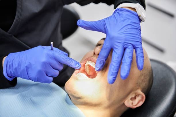 Best Broken or Chipped Tooth Repair in Bakersfield Country Clu, CA